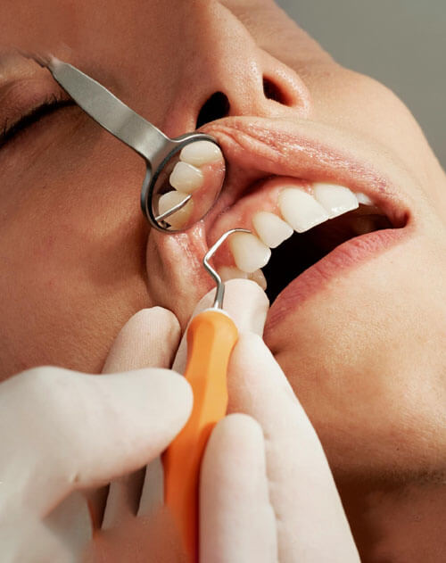 Periodontics