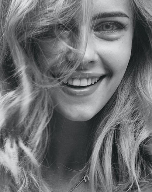 Veneers